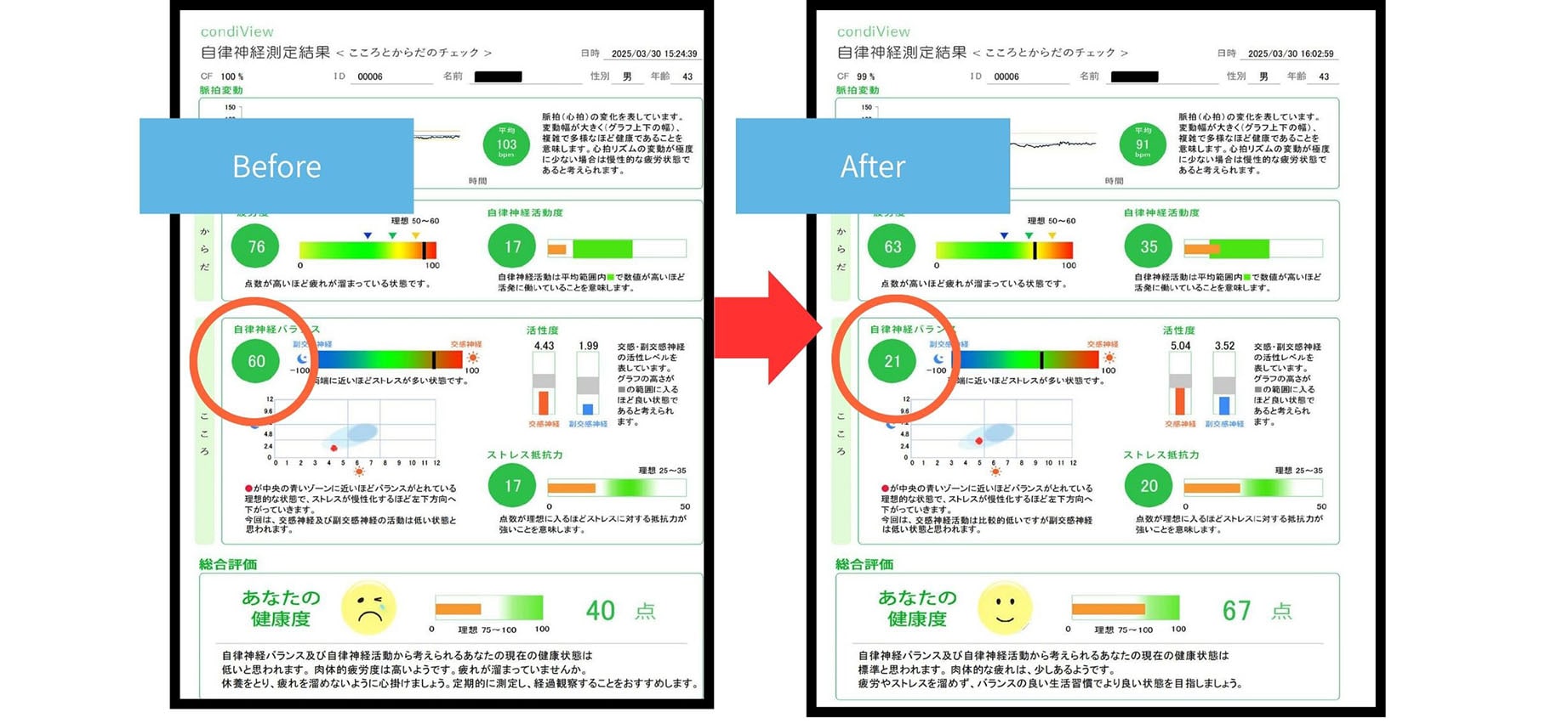 施術前後の自律神経測定結果比較